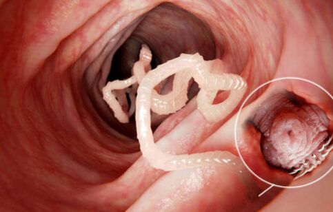 cacing adalah parasit dalam tubuh manusia